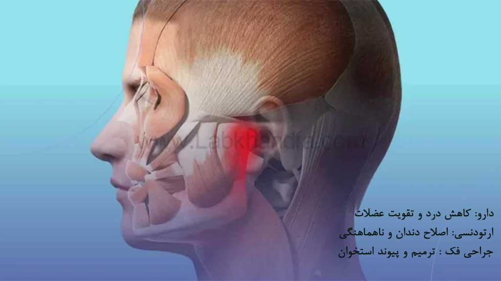 درمان مشکلات استخوان فک