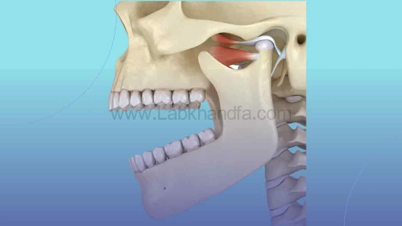 استخوان فک بالا و پایین