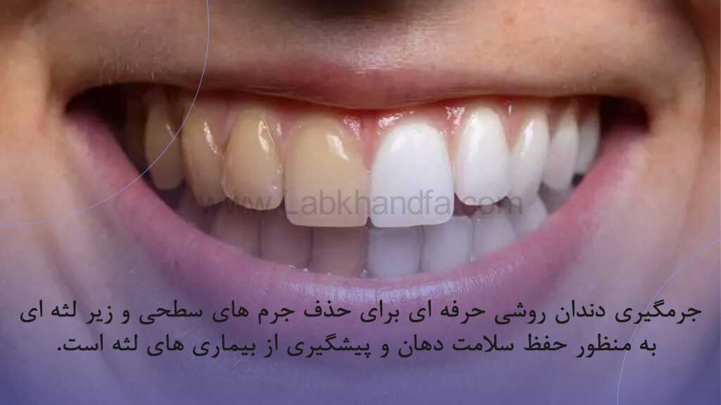 جرم گیری چیست؟