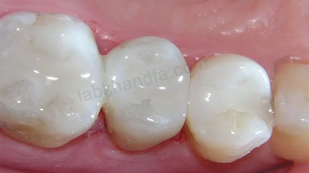 سرامیک