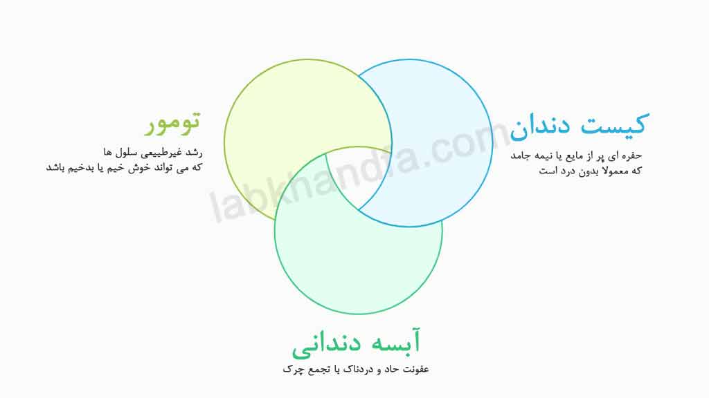 تفاوت کیست دندان با آبسه و تومور