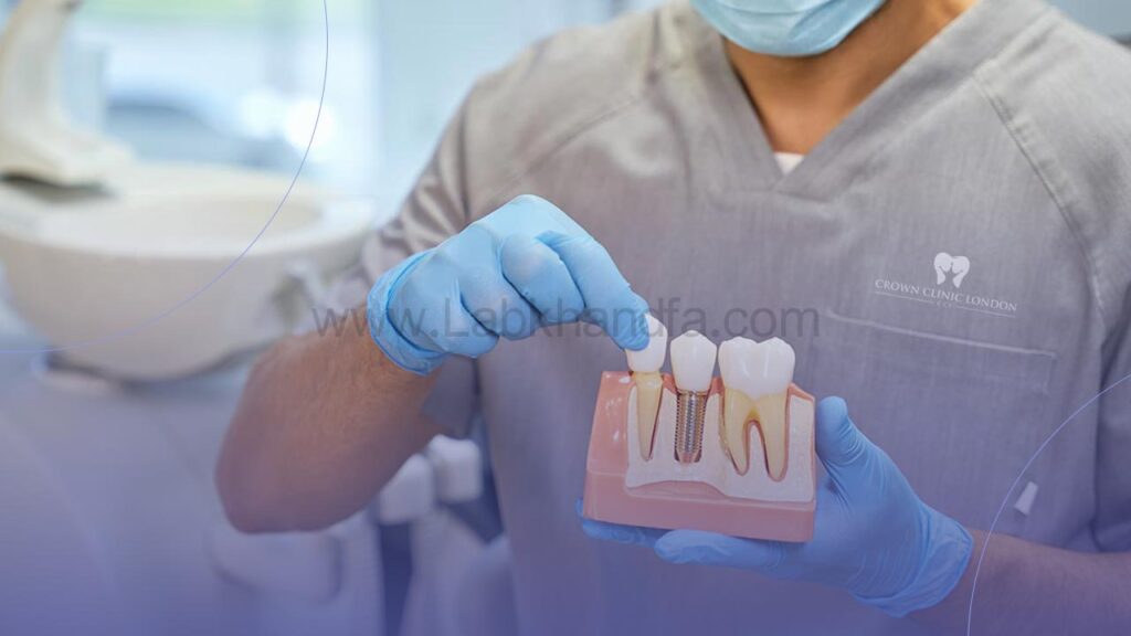 متخصص پروتزهای دندانی