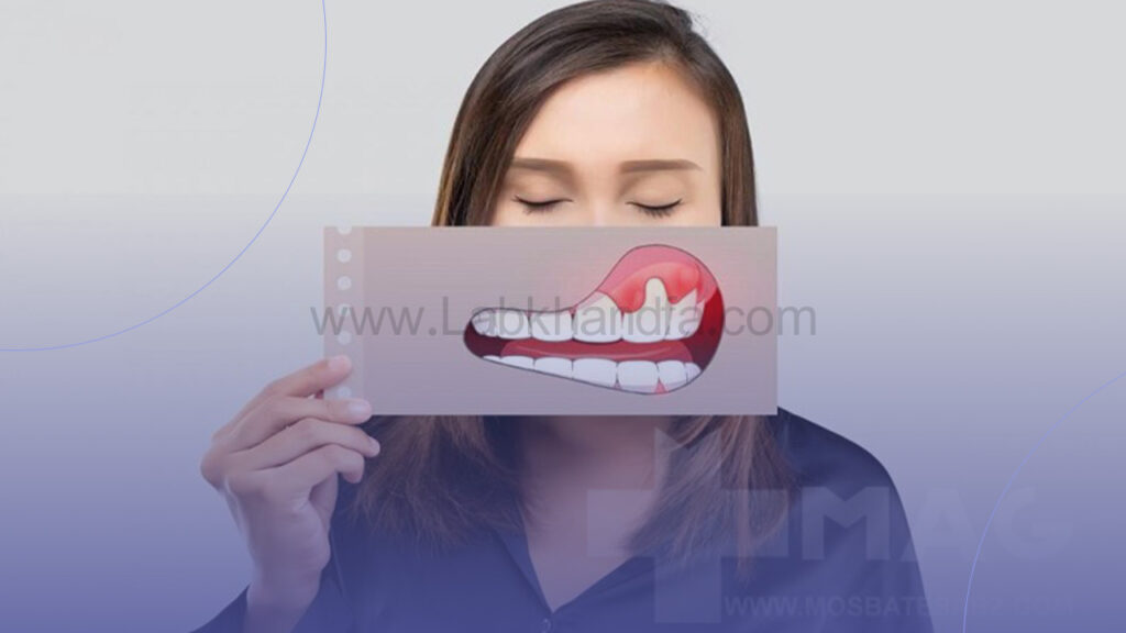 علائم التهاب لثه