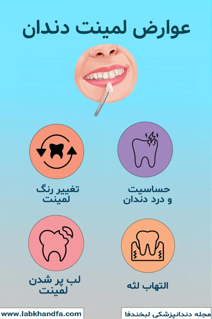 عوارض لمینت دندان