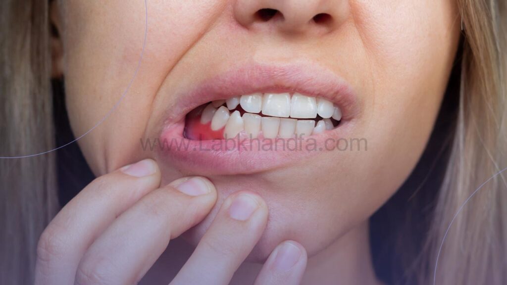 تصویری از عفونت لثه