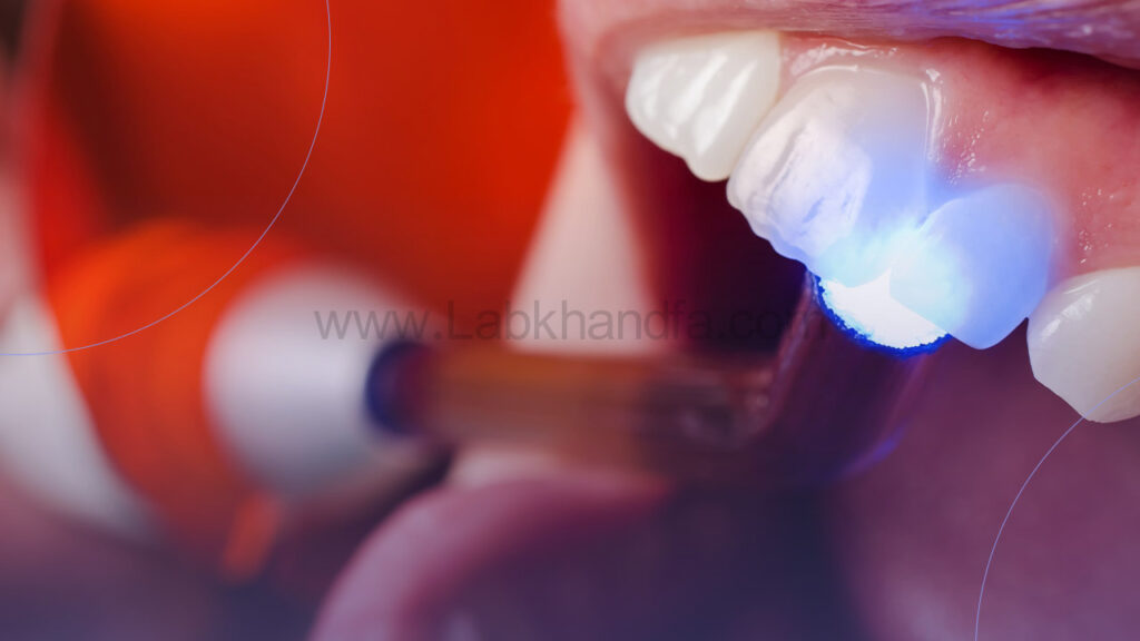 جراحی لثه با لیزر