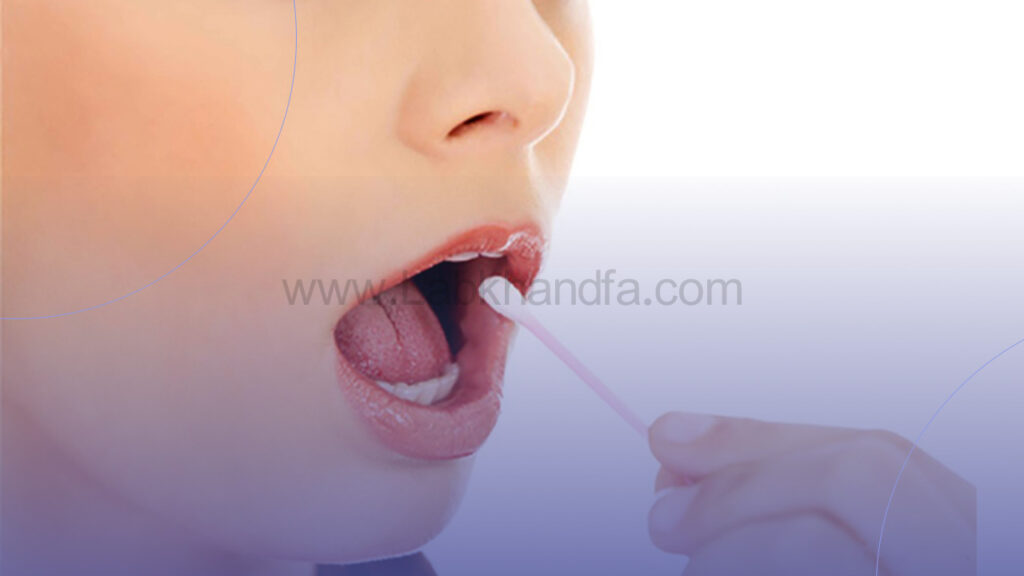 استفاده از پماد مخصوص برای درمان آفت دهانی 