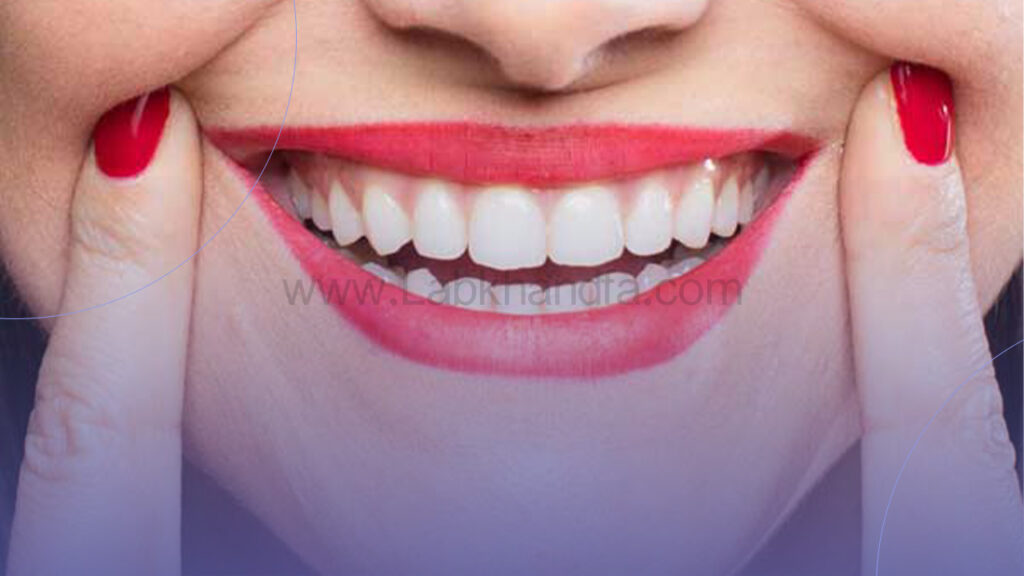 افزایش زیبایی طرح لبخند با اجرای فرآیند لیفت لثه