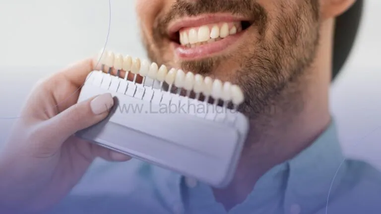 بهترین رنگ لمینت دندان