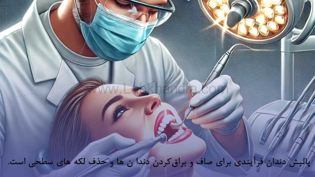 پالیش دندان چیست؟