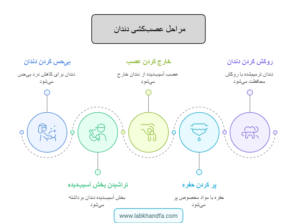 اینفوگرافی مراحل عصب کشی دندان