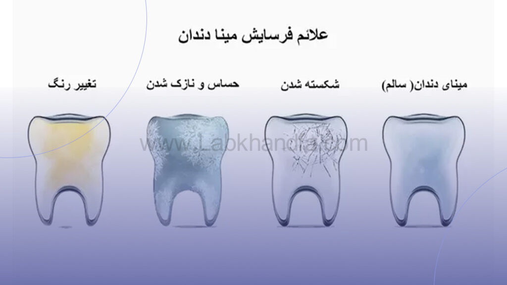 علائم فرسایش دندان