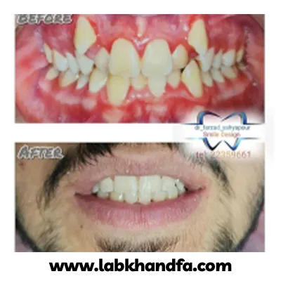 نمونه کار درمان ارتودنسی دکتر فرزاد یحیی پور