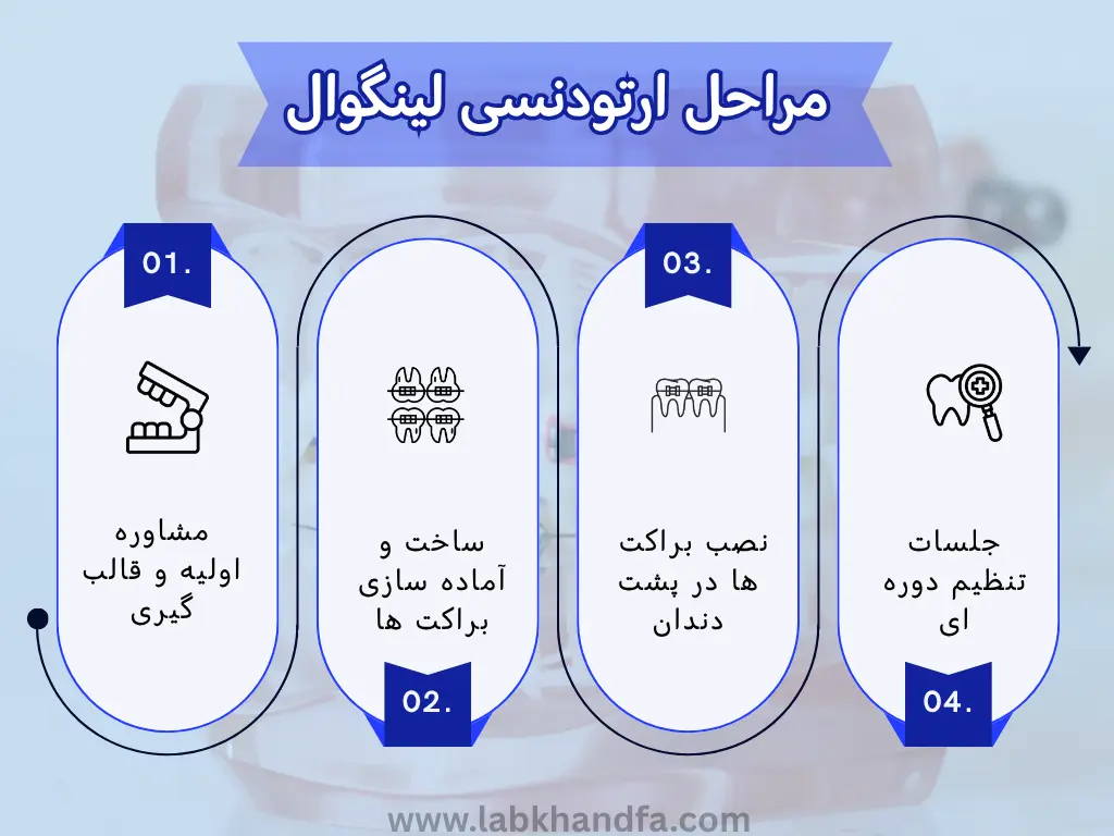 مراحل ارتودنسی لینگوال 
