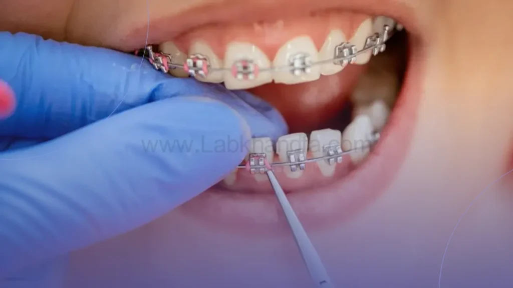 تنظیم صحیح وسایل ارتودنسی برای کاهش زمان درمان