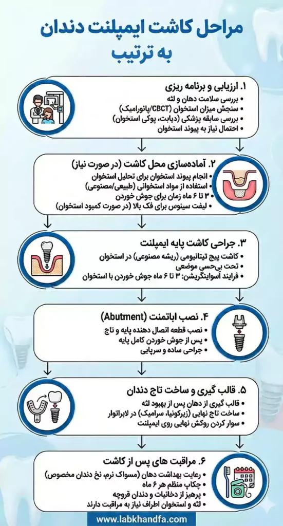 مراحل کاشت ایمپلنت به ترتیب