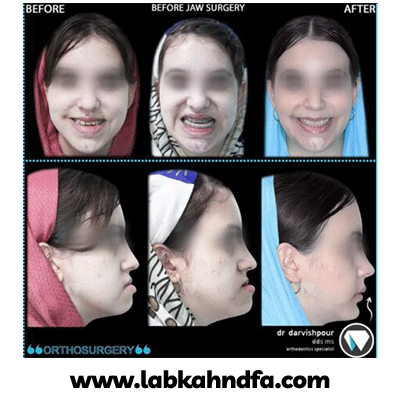نمونه کار ارتودنسی دکتر هادی درویش پور