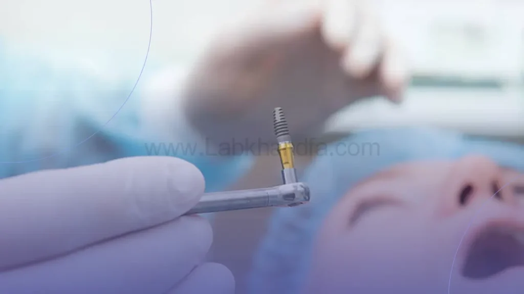 کاشت ایمپلنت داخل استخوان فک