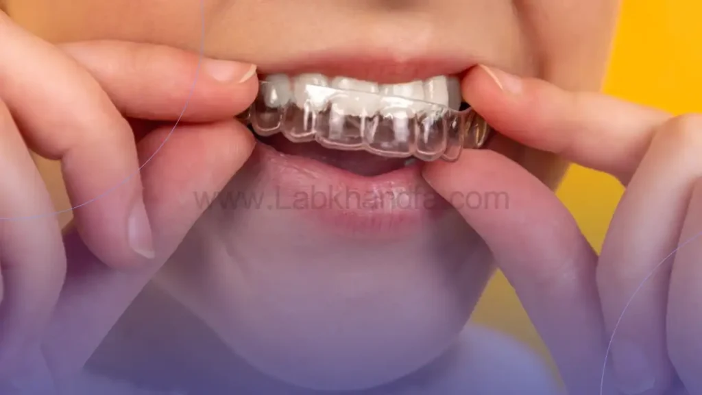 ارتودنسی نامرئی با الاینرهای شفاف