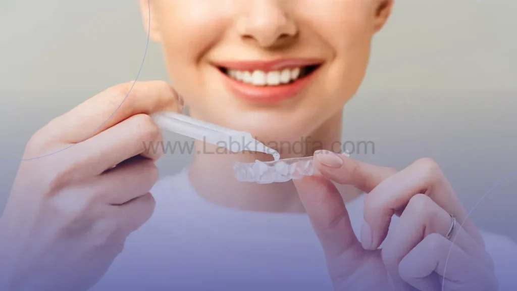 بلیچینگ دندان در خانه