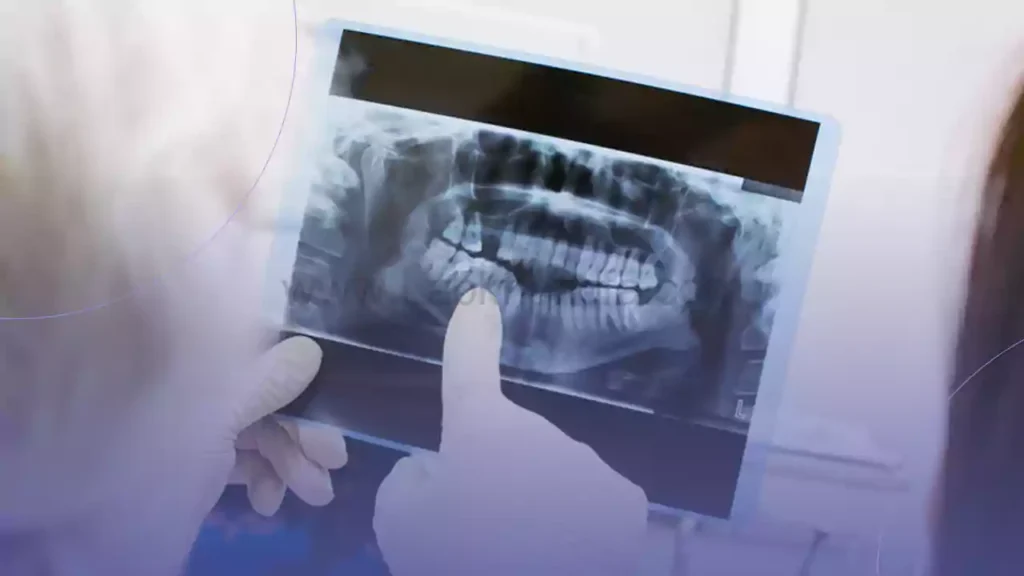 تصویربرداری دهان (دومین مرحله ارتودنسی دندان)