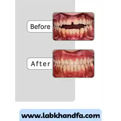 یک نمونه کار ارتودنسی دندان دکتر سهیل سالاری