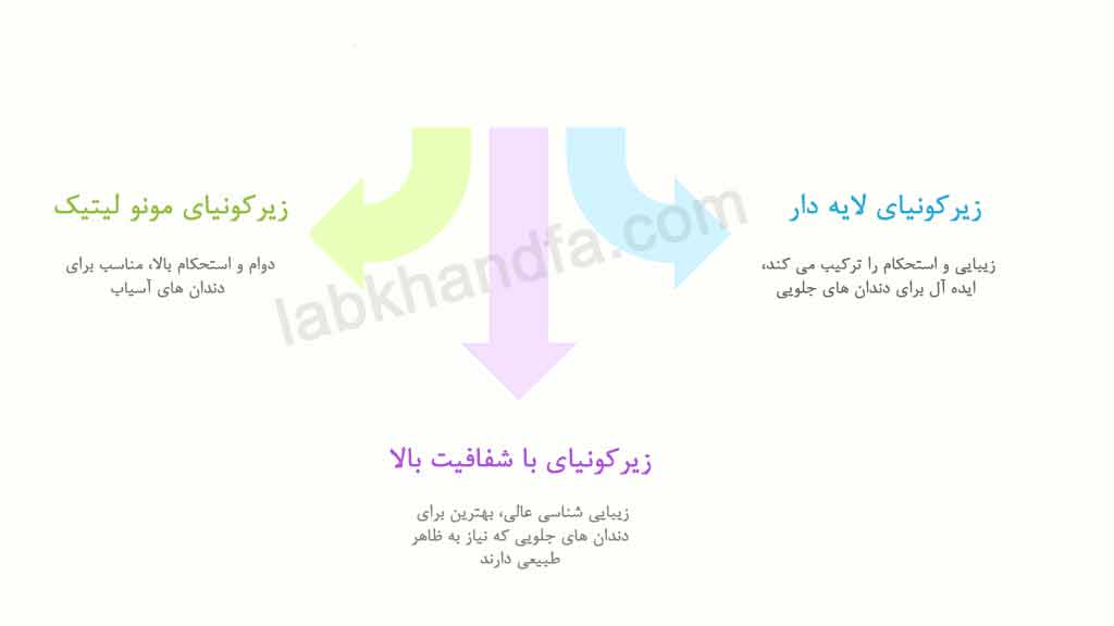 انواع روکش زیرکونیا