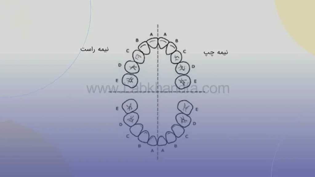 شماره گذاری دندان ها به روش یونیورسال