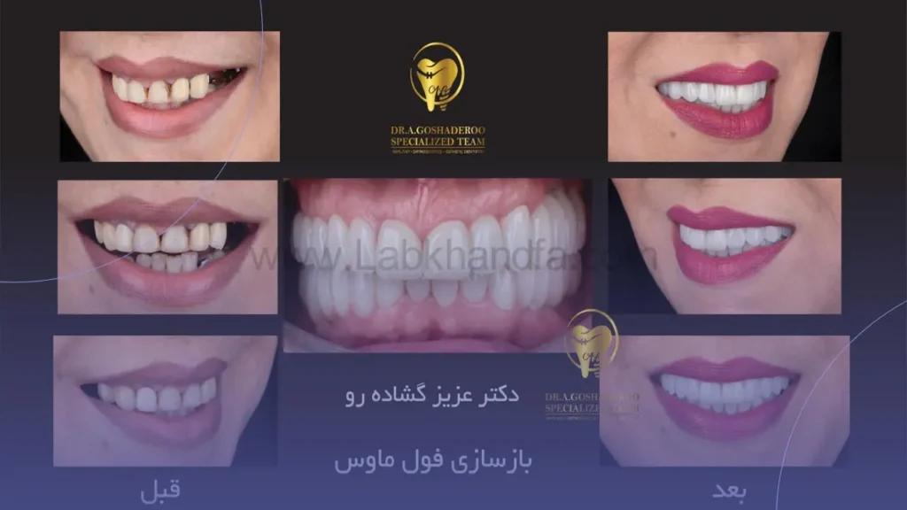 نمونه کار دکتر گشاده رو