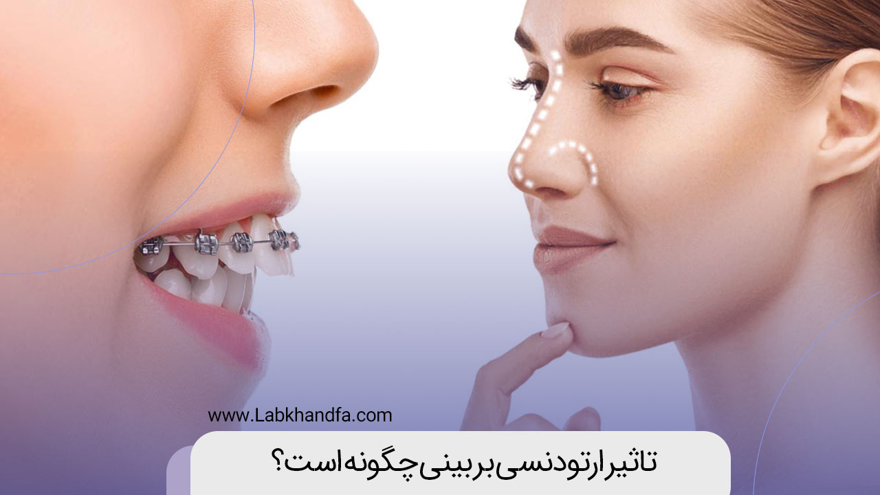 تاثیر ارتودنسی بر بینی