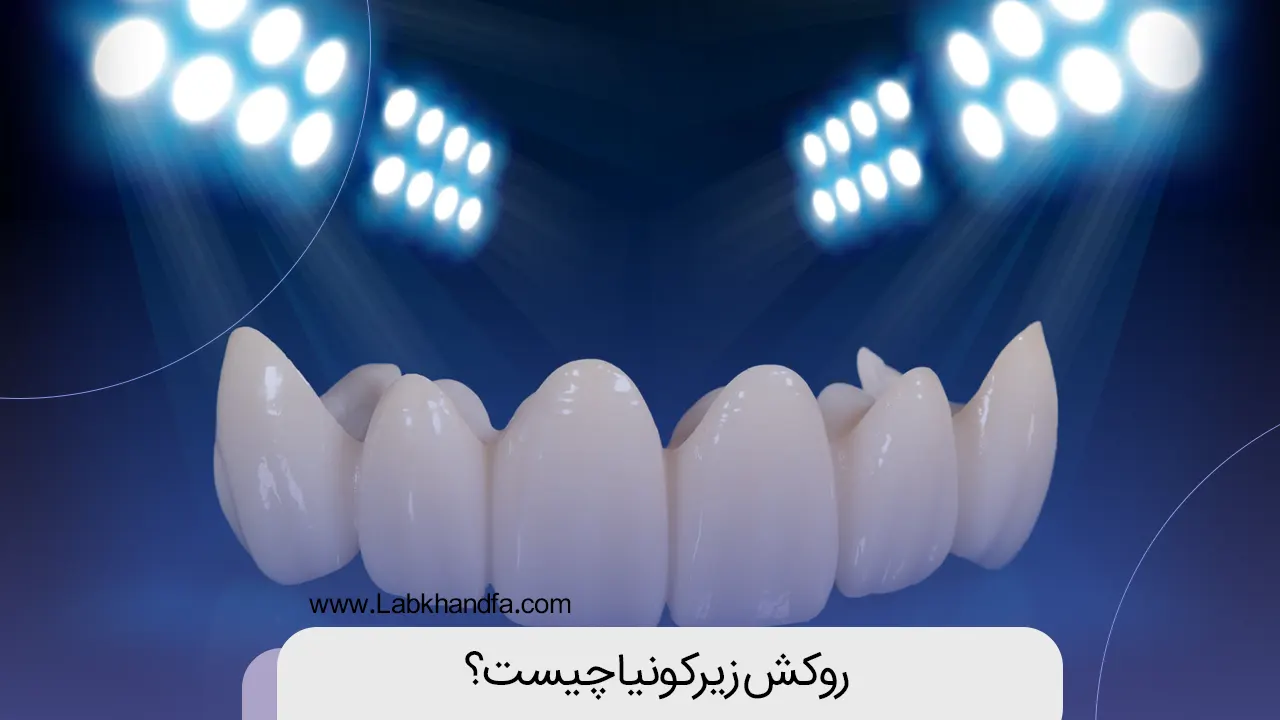 روکش زیرکونیا دندان شاخص