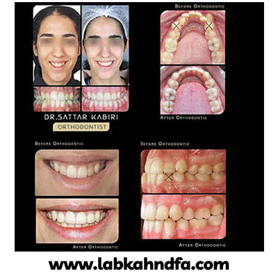 نمونه کار ارتودنسی دکتر ستار کبیری