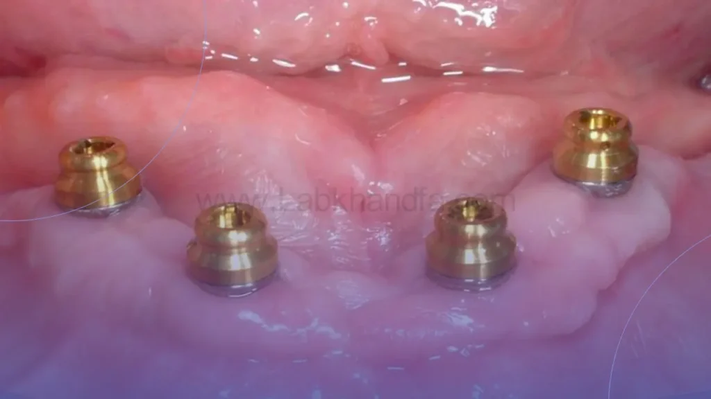 عکس پایه اوردنچر