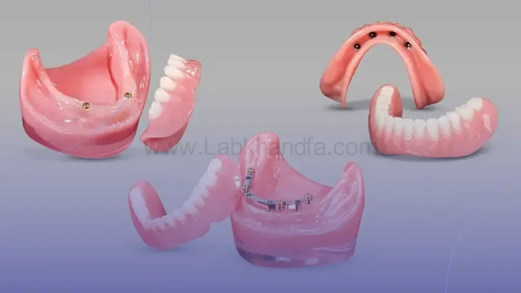 عکس اوردنچر و پابه ها
