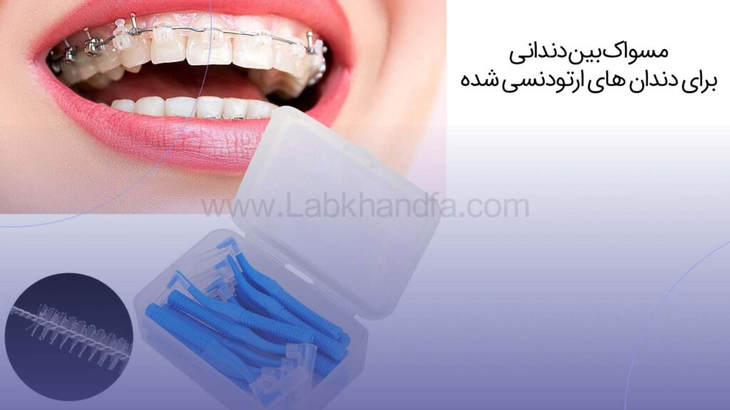 مسواک ارتودنسی