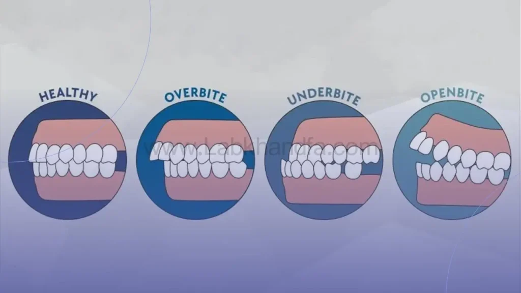 مشکلات اوپن بایت و اوربایت