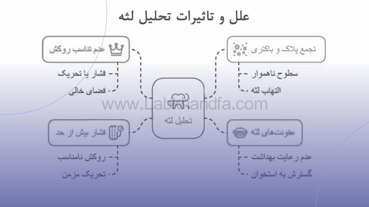 تحلیل لثه در دندان های روکش شده