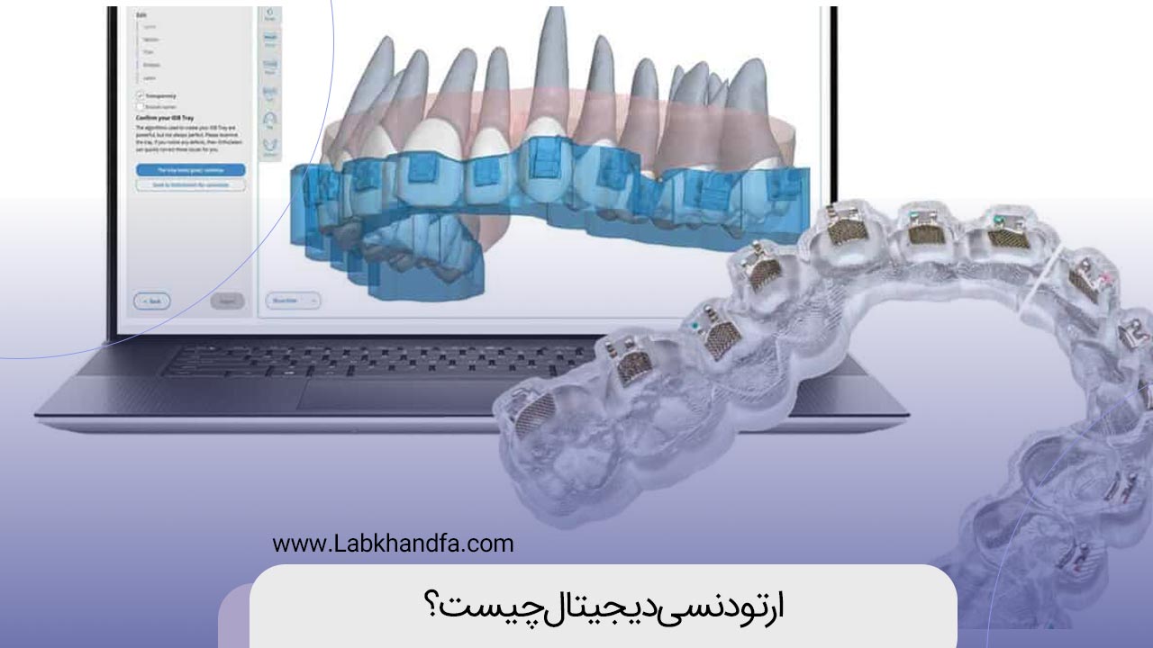 ارتودنسی دیجیتال چیست؟