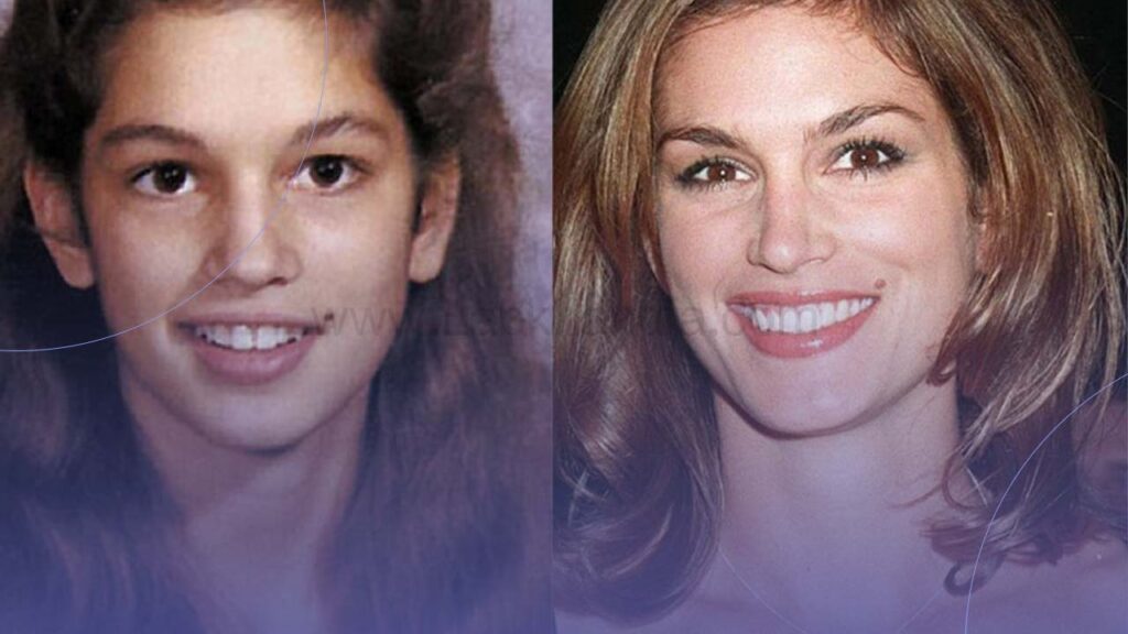 تاثیر ارتودنسی بر فرم صورت