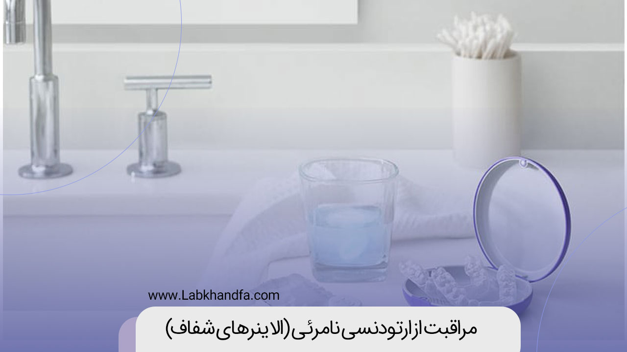 مراقبت از ارتودنسی نامرئی