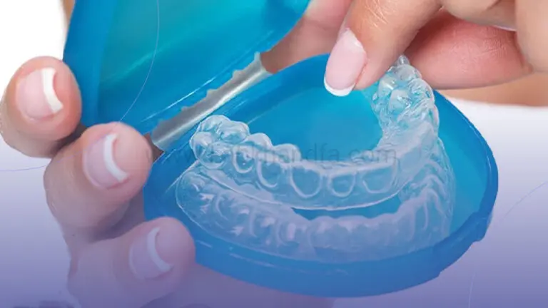 نگهداری از ارتودنسی نامرئی