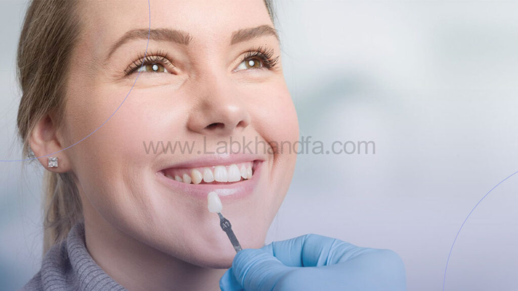 عکس از انتخاب بهترین رنگ لمینت دندان