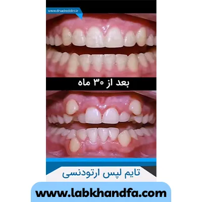 نمونه کار ارتودنسی دکتر فرهاد صدرالدینی