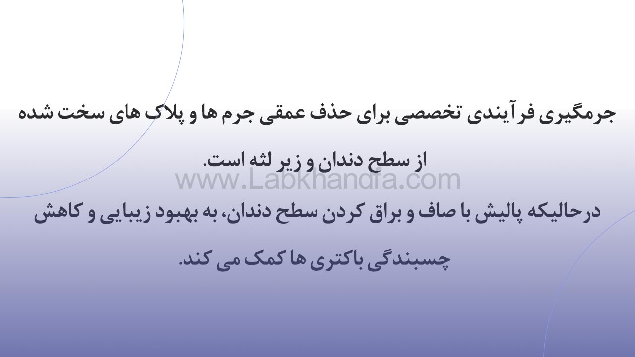 تفاوت جرم گیری و پالیش دندان