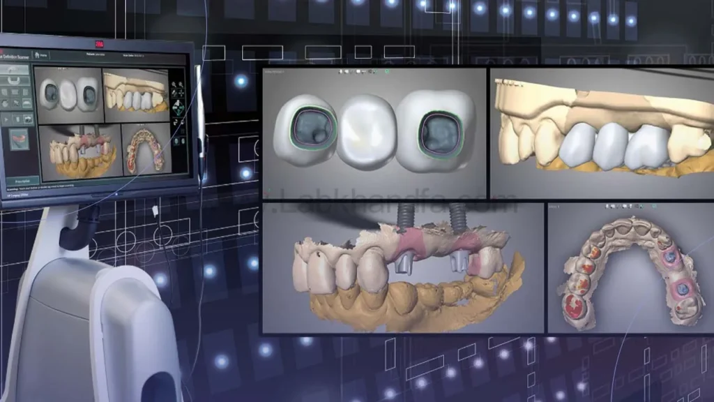 فرآیند ایمپلنت دیجیتال با تجهیزات مدرن