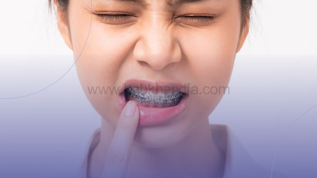 درد ارتودنسی