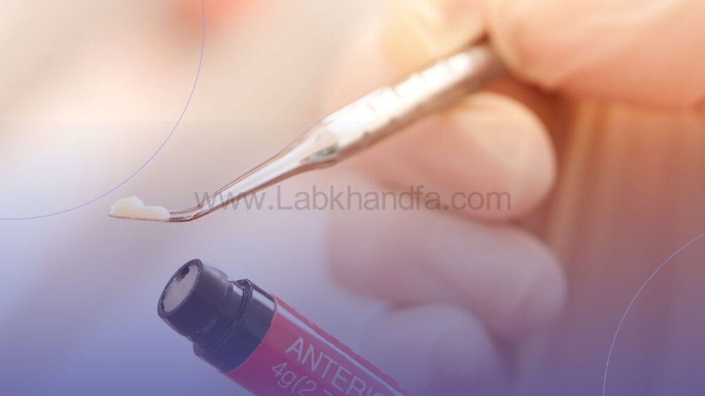 کامپوزیت دندان