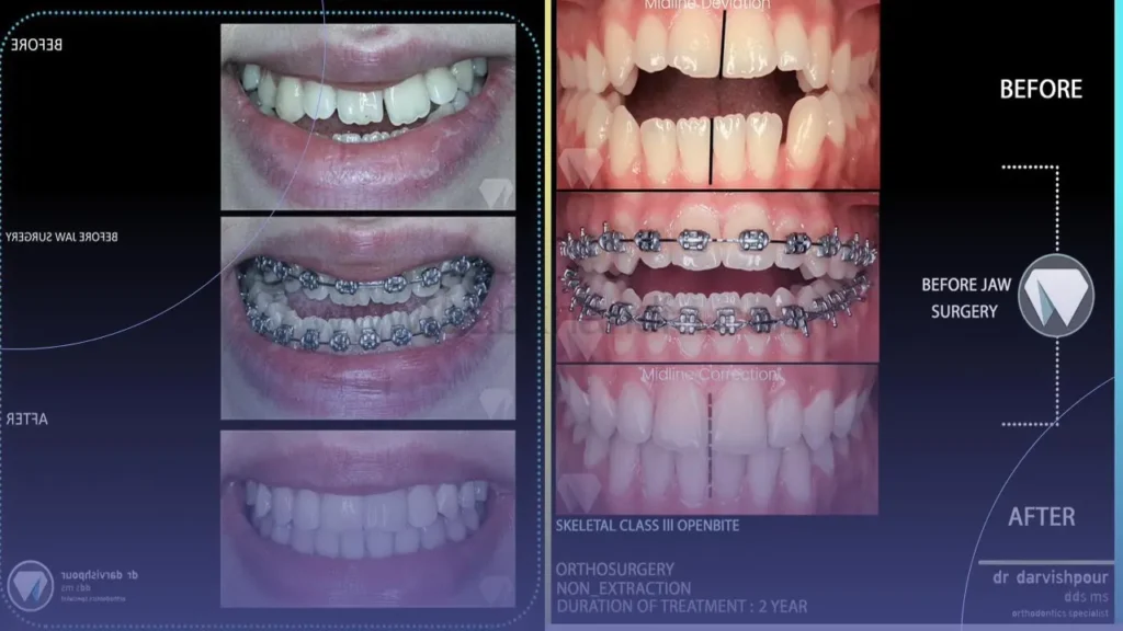 نمونه کار دکتر ارتودنسی 