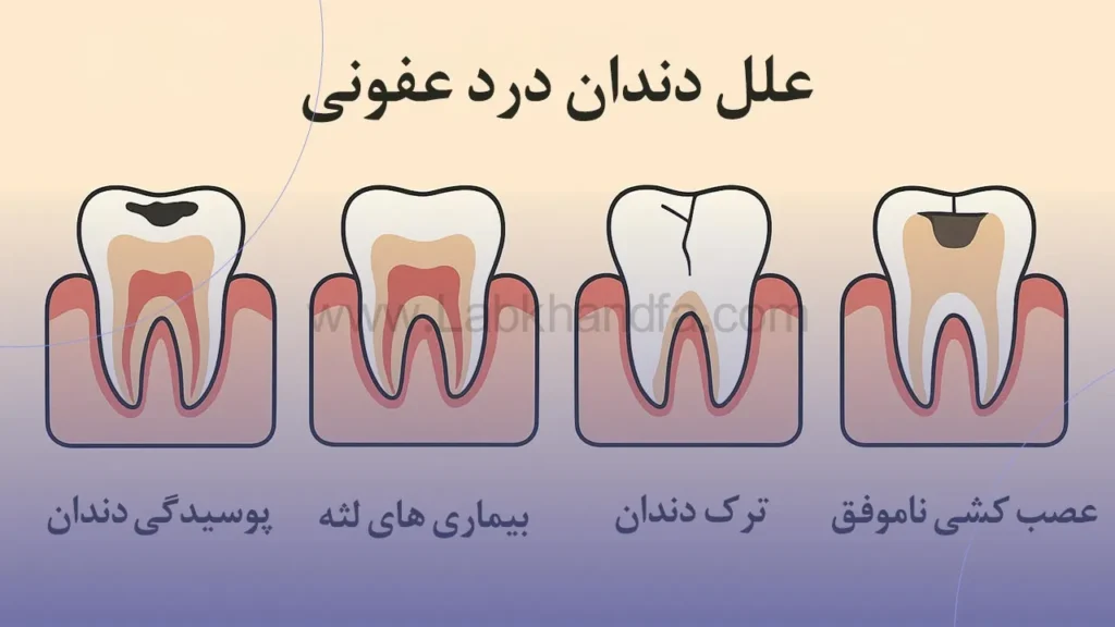 علل دندان درد عفونتی