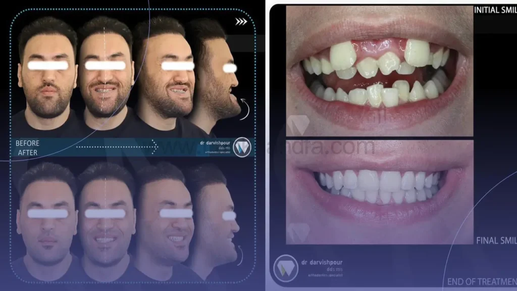 نمونه کار متخصص ارتودنسی 